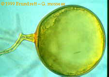 Single Glomus spore, taken from M. Brundrett