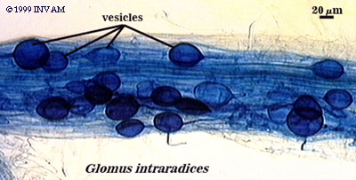 Vesicles, courtesy of INVAM