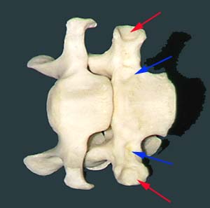 Cervical Transverse Process