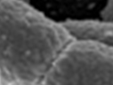 YagU: an Acid-Resistance Protein of the Escherichia coli Inner Membrane